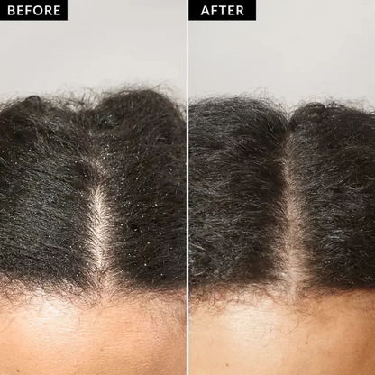 Zesia Scalp Massager Brush